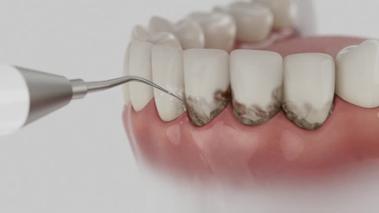 Reliable Dental contractor in Lake Dalecarlia, IN by Dentist Open Now